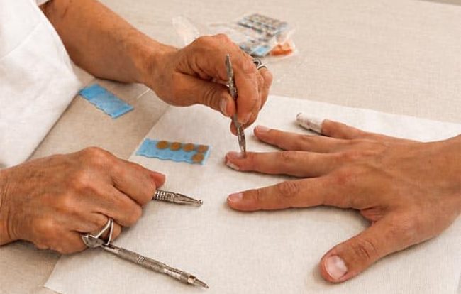 manupuncture_pratique_1 copie