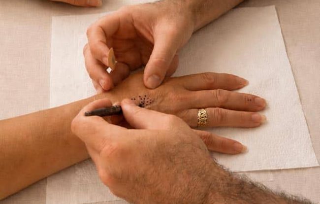 manupuncture_pratique_2 copie